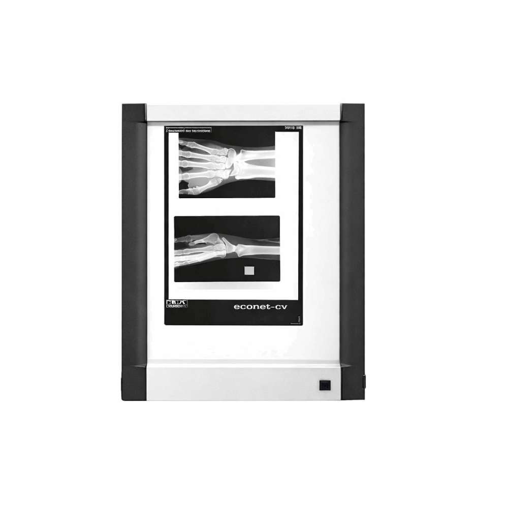 Mobilier Medical NEGATOSCOPE Ultra-Fin LED 1-2-3-4 OPTIMIUM